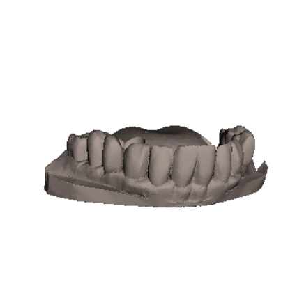 INMOOV BottomTeethV1.stl