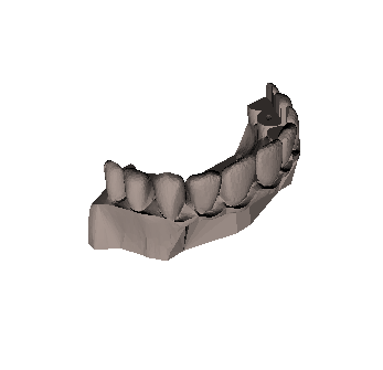 INMOOV TopTeethV3.stl